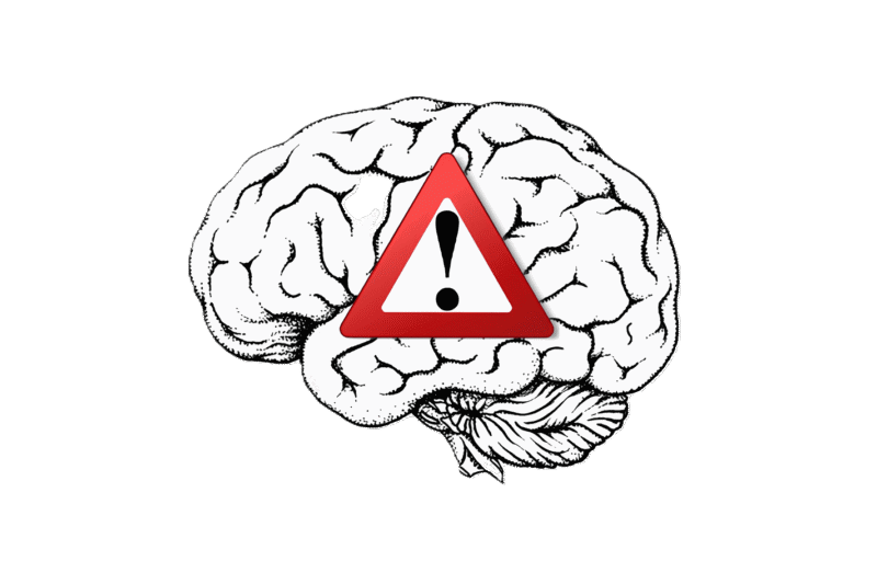 Brain Background Removed
